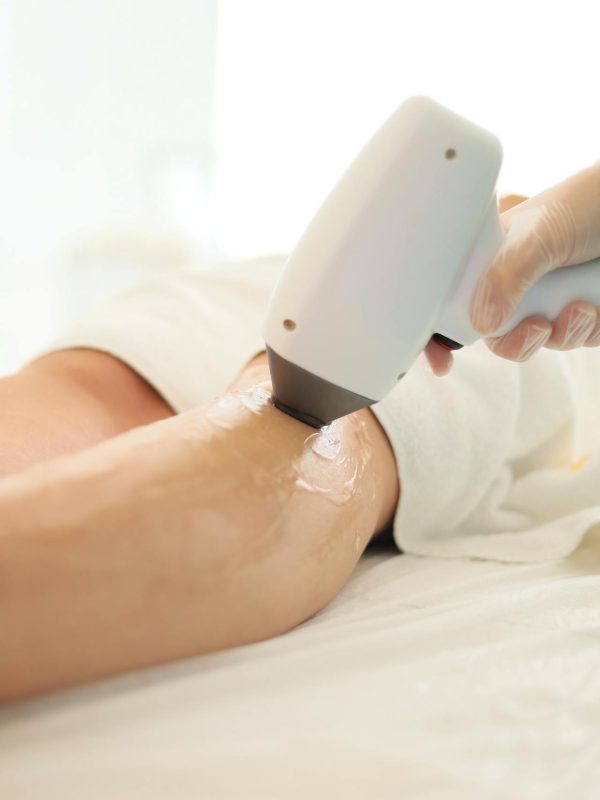 full body laser hair removal in lucknow