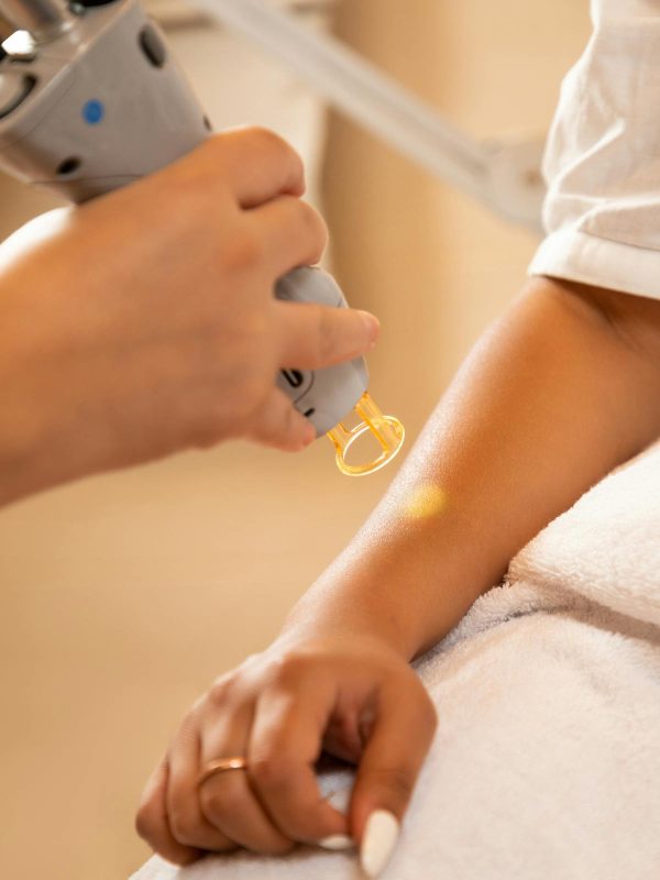 lucknow laser hair removal permanent