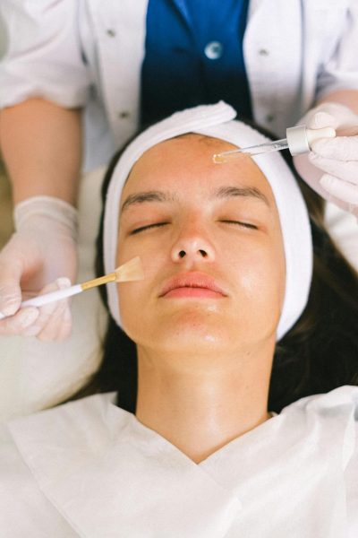 chemical peel treatment in lucknow